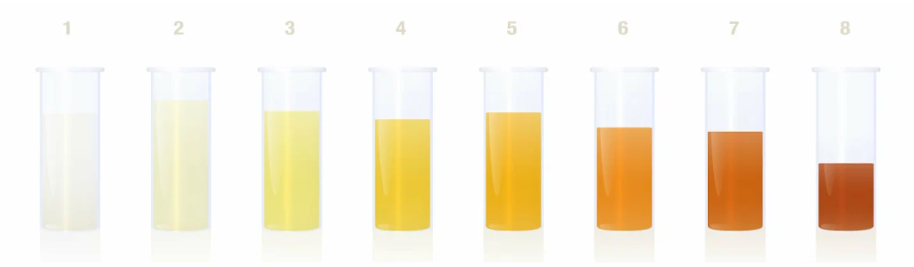 Welke kleur heeft jouw urine?