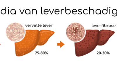 Leververvetting herkennen en herstellen