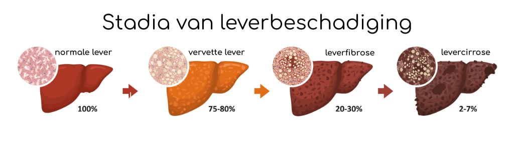 Test de gezondheid van jouw lever bij BinnensteBuiten Delft